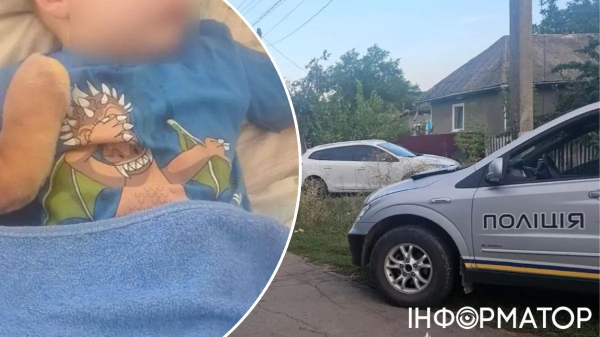 Батьки 2,5-річного хлопчика, збитого працівником ТЦК, розповіли про стан сина